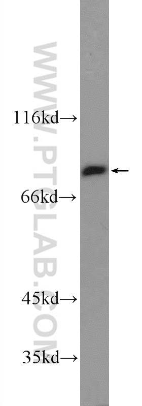 Western Blot (WB) analysis of mouse skin tissue using TGM5 Polyclonal antibody (25071-1-AP)