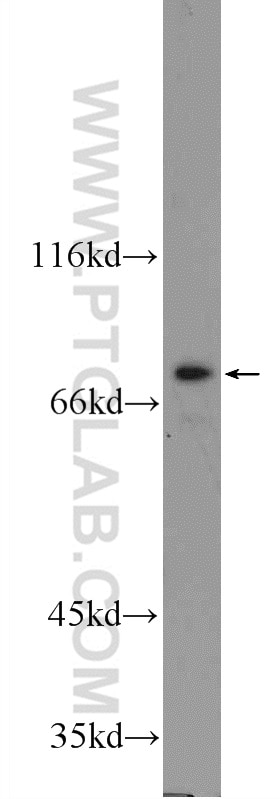 Western Blot (WB) analysis of A431 cells using TGM5 Polyclonal antibody (25071-1-AP)