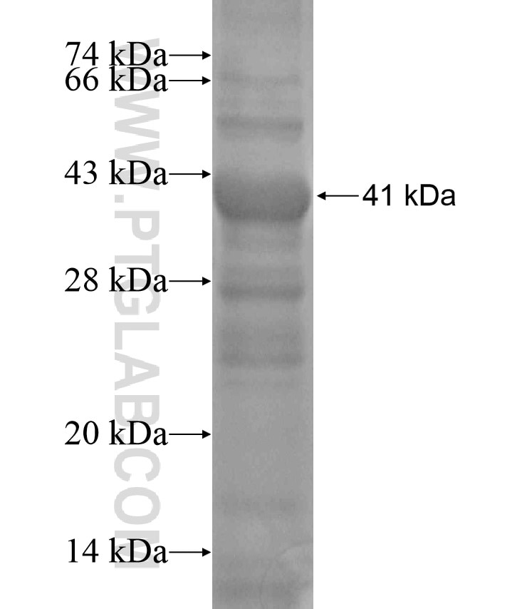 TGM5 fusion protein Ag18426 SDS-PAGE