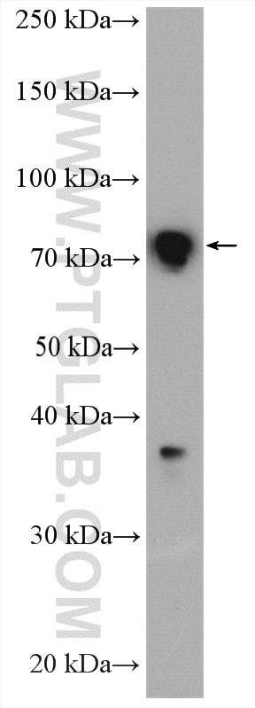 Western Blot (WB) analysis of mouse colon tissue using TGM7 Polyclonal antibody (27748-1-AP)