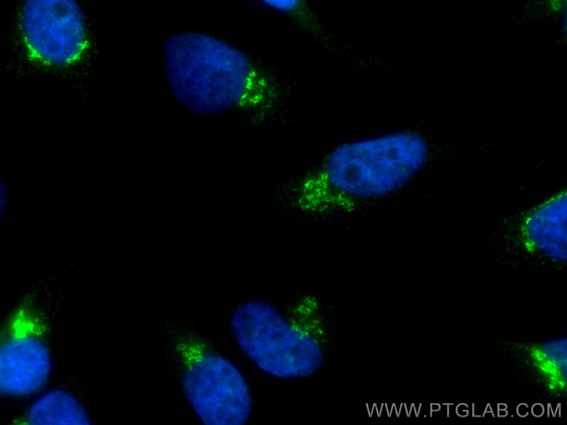 Immunofluorescence (IF) / fluorescent staining of HeLa cells using CoraLite® Plus 488-conjugated TGN46 Polyclonal ant (CL488-13573)