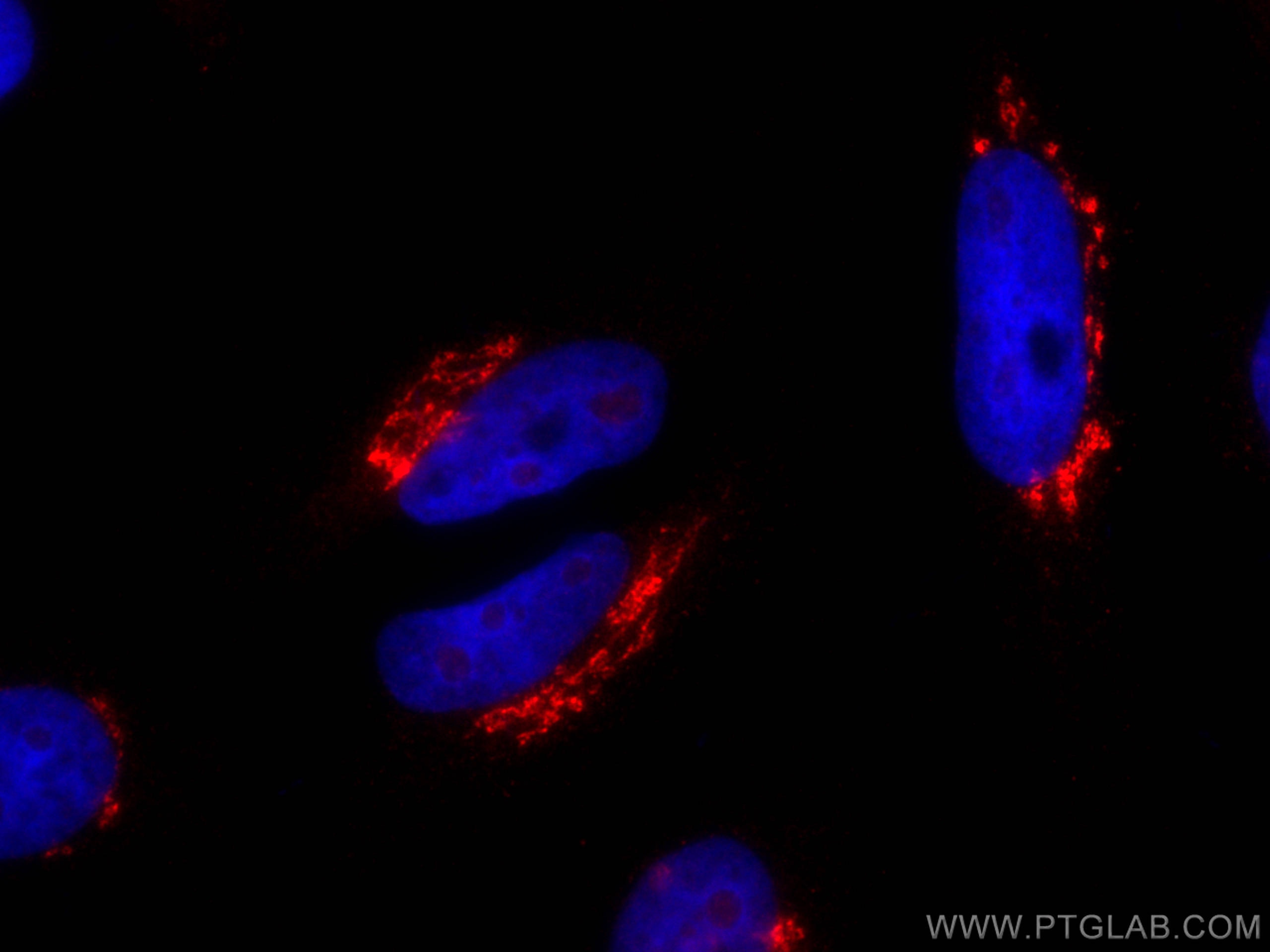 Immunofluorescence (IF) / fluorescent staining of HeLa cells using CoraLite®594-conjugated TGN46 Polyclonal antibody (CL594-13573)