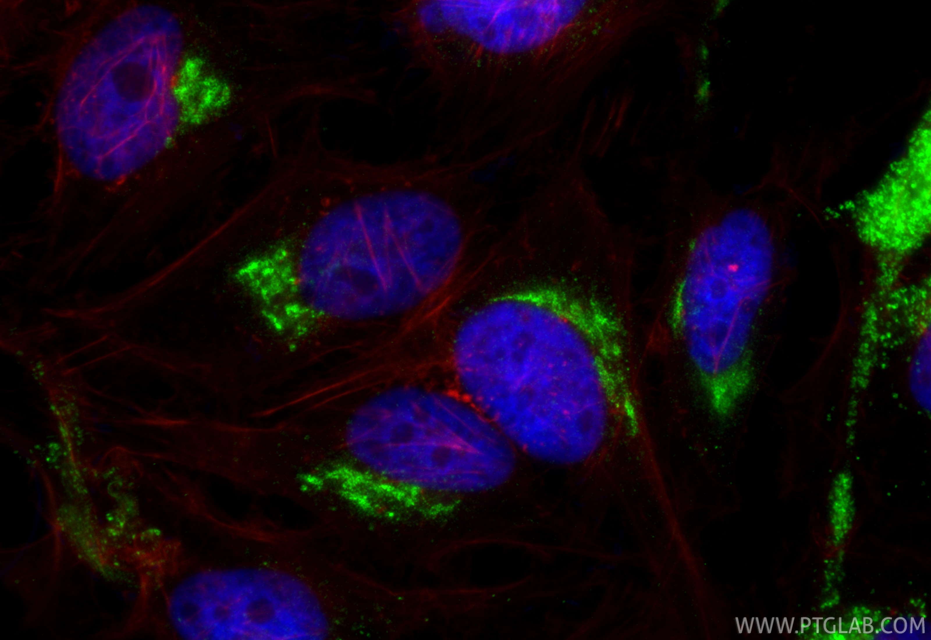 IF Staining of HeLa using RMX00075 Immunofluorescence (IF) / fluorescent staining of HeLa cells using Multi-rAb® TGN46 Multi-Recombinant antibody (RMX00075)
