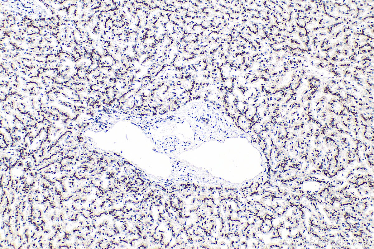 IHC staining of human liver using RMX00075 Immunohistochemistry (IHC) staining of human liver tissue using Multi-rAb® TGN46 Multi-Recombinant antibody (RMX00075)