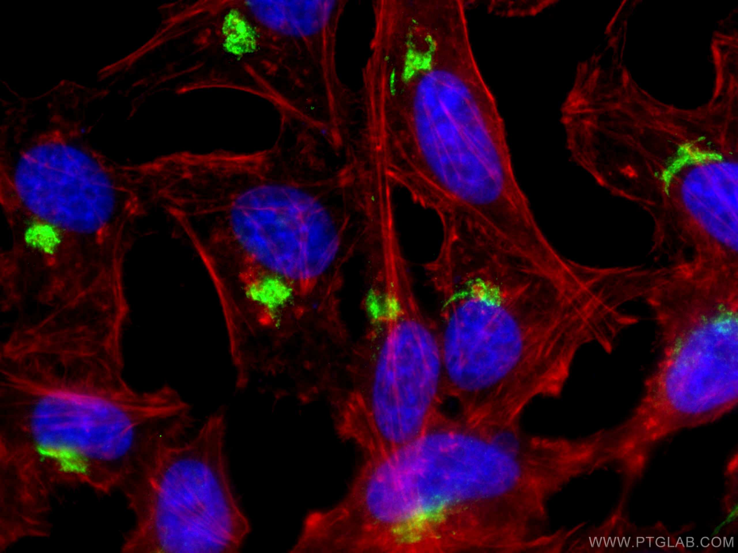 IF Staining of HeLa using 13573-1-AP