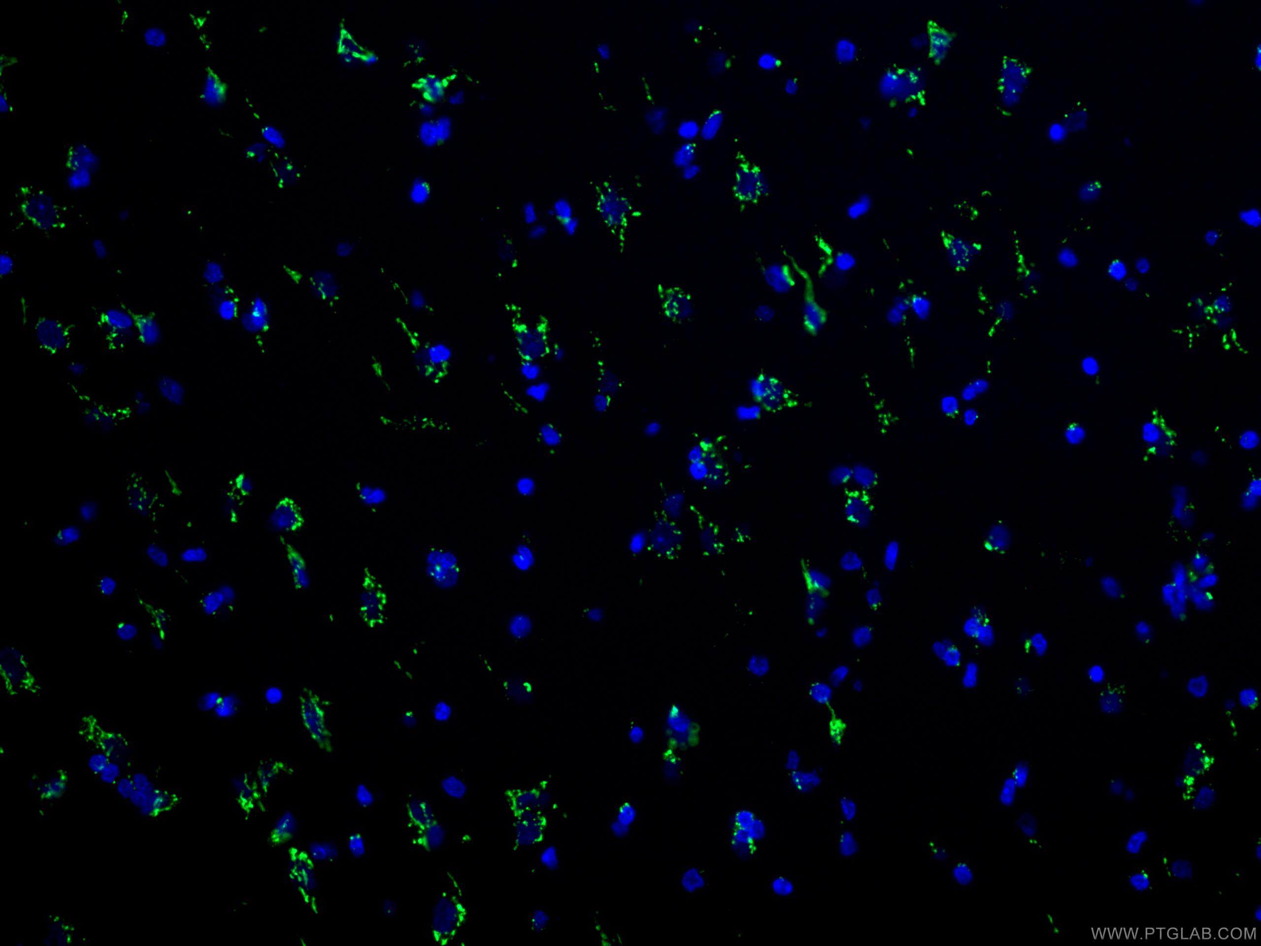 Immunofluorescence (IF) / fluorescent staining of human cerebellum tissue using TGN46 Polyclonal antibody (13573-1-AP)