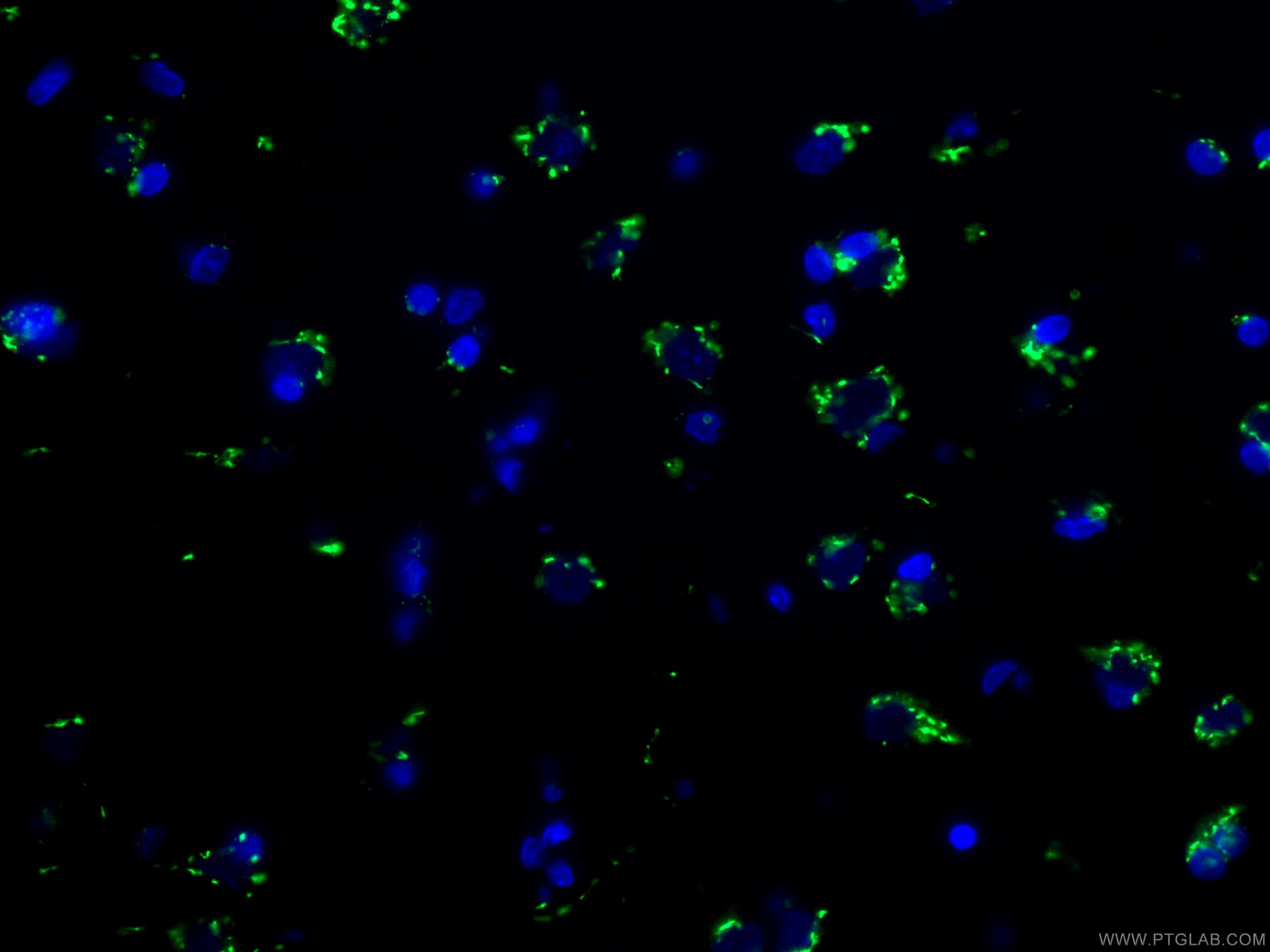 Immunofluorescence (IF) / fluorescent staining of human cerebellum tissue using TGN46 Polyclonal antibody (13573-1-AP)