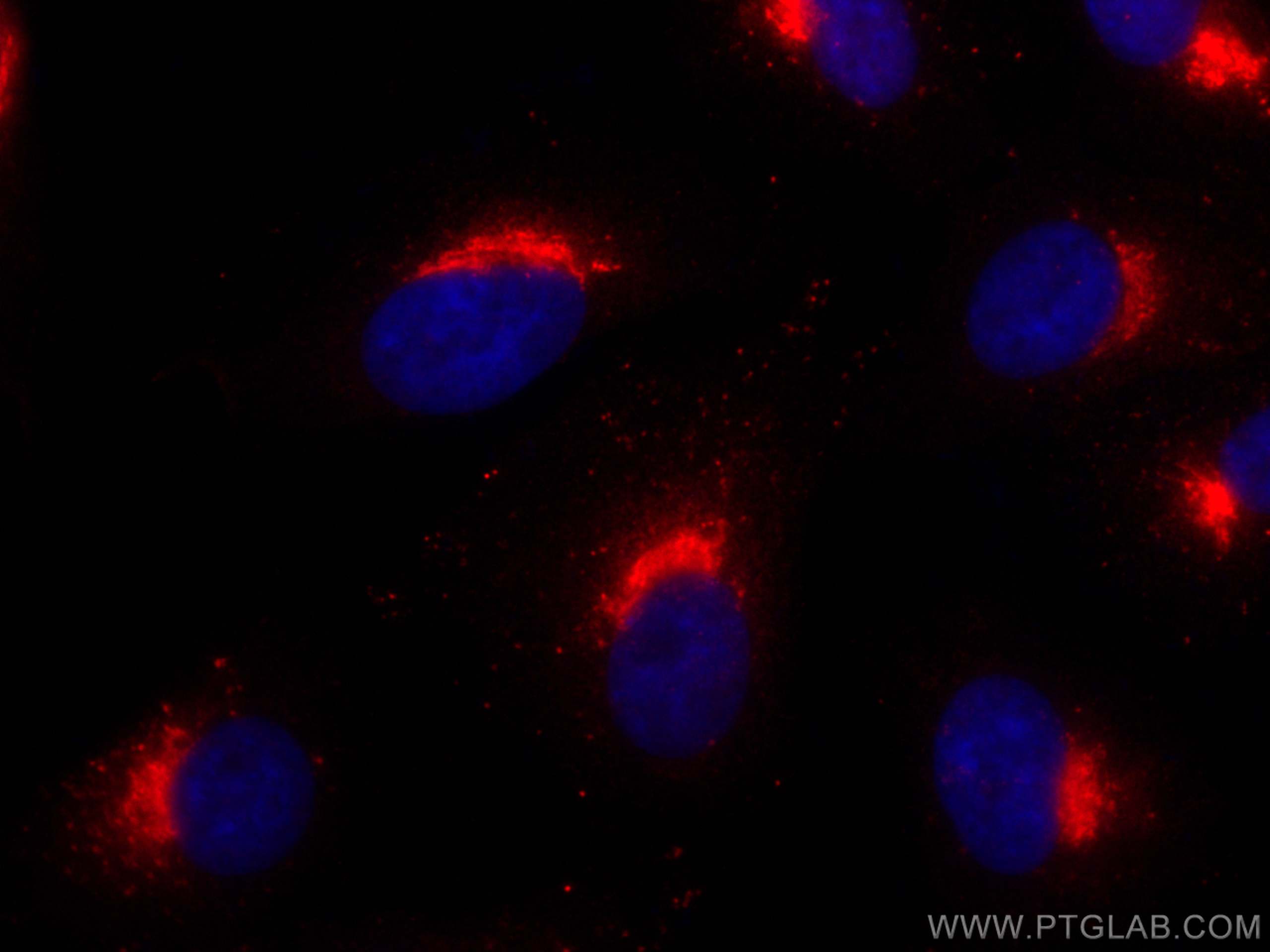Immunofluorescence (IF) / fluorescent staining of A549 cells using TGN46 Polyclonal antibody (13573-1-AP)