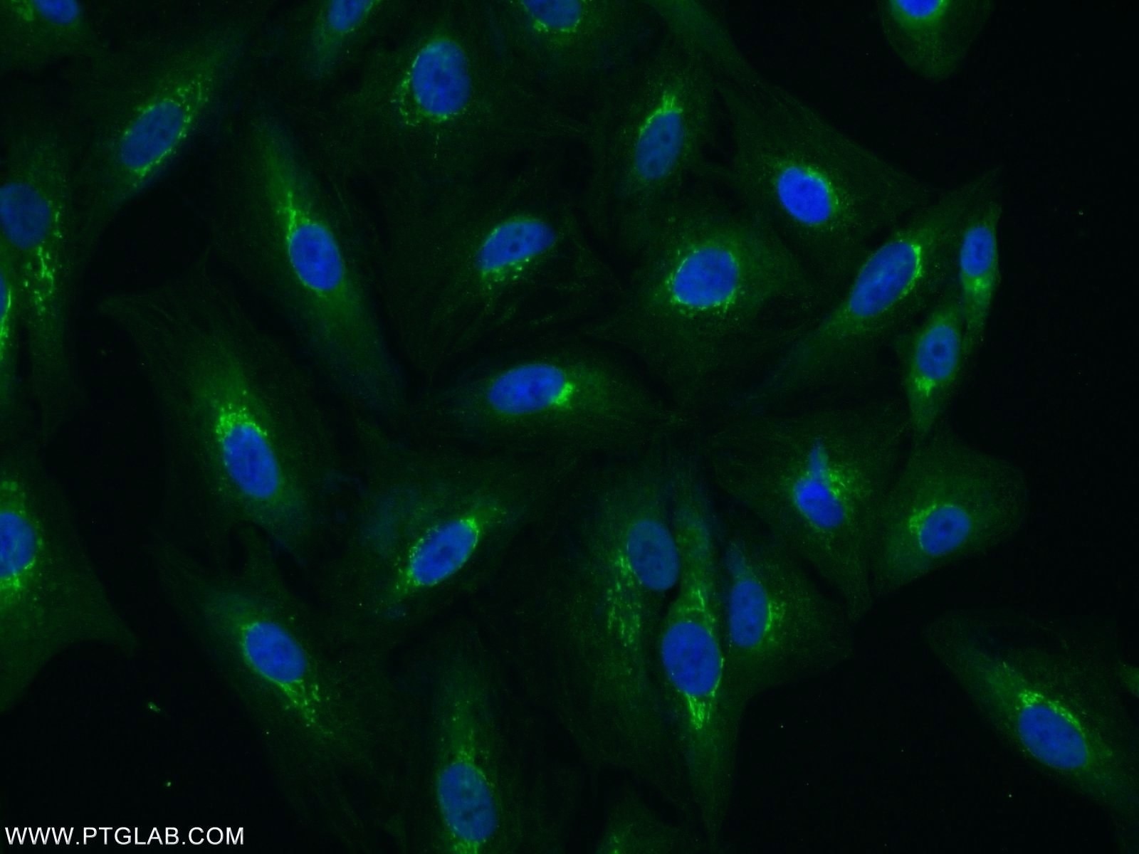 TGN46 Polyclonal antibody