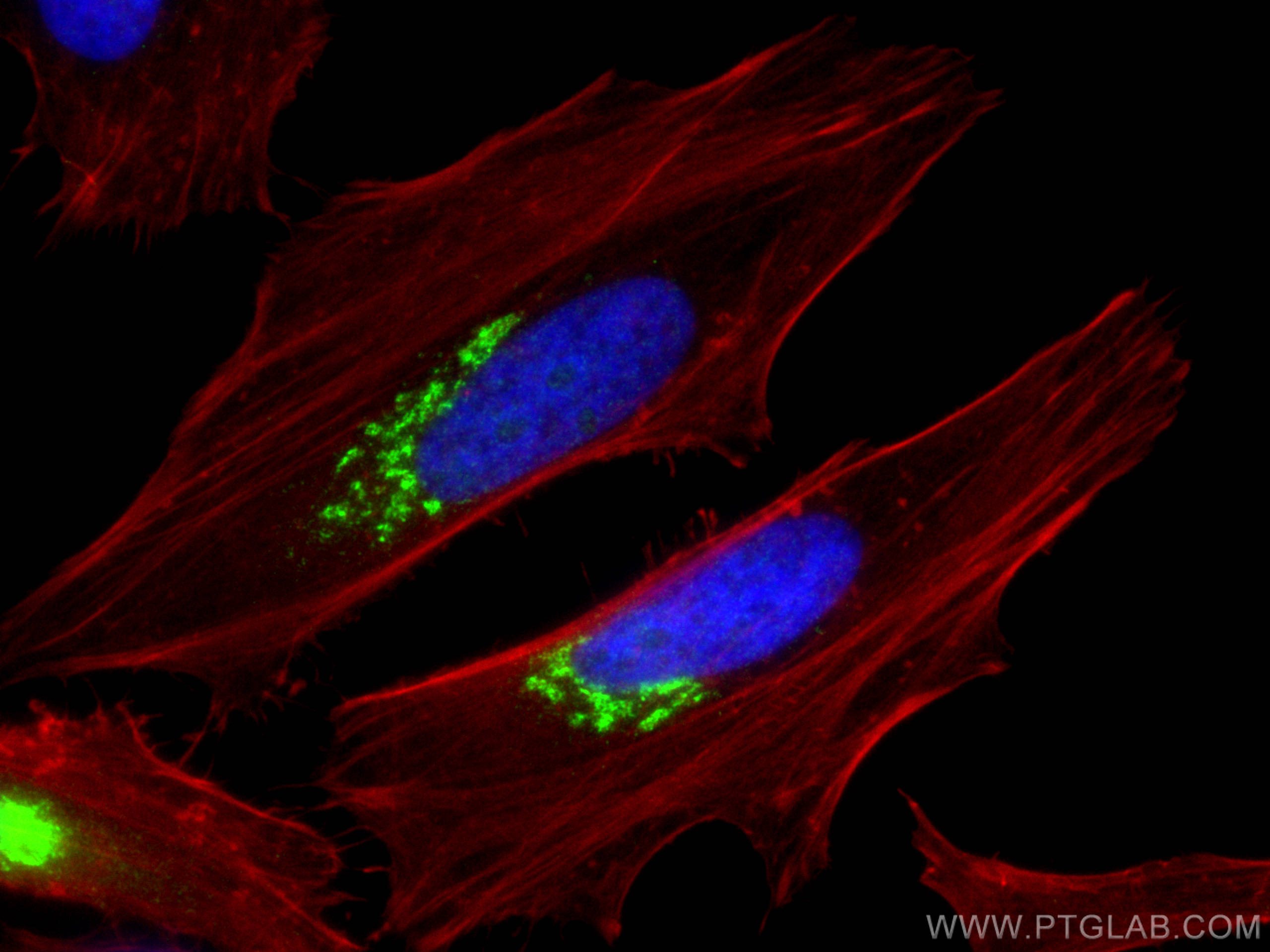 Immunofluorescence (IF) / fluorescent staining of HeLa cells using TGN46 Polyclonal antibody (13573-1-AP)