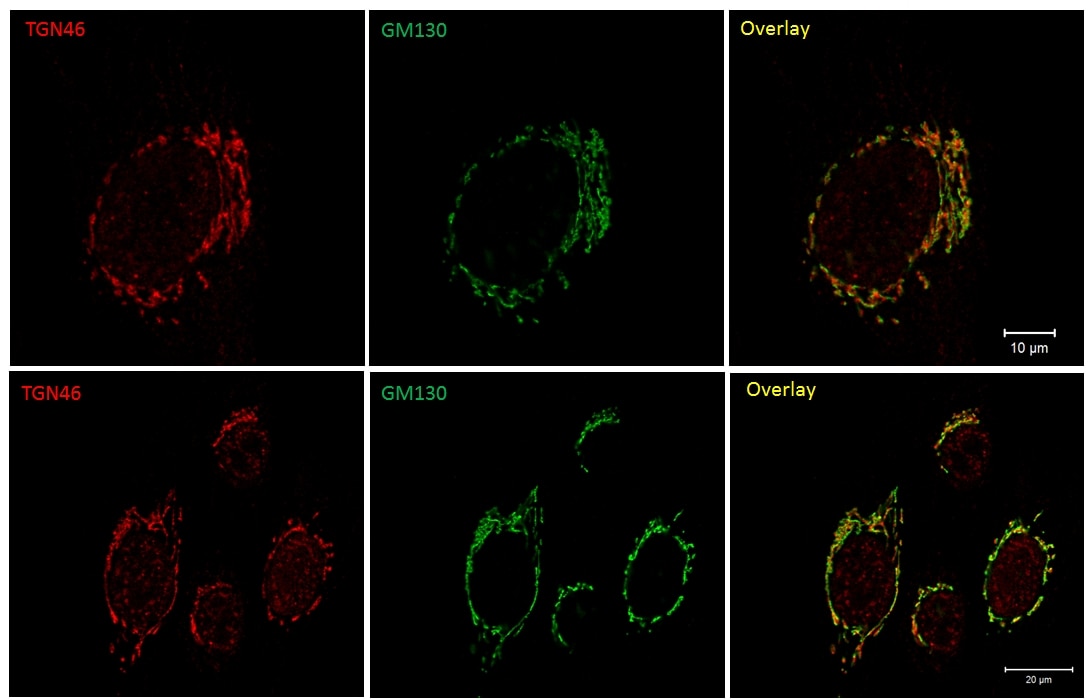Immunofluorescence (IF) / fluorescent staining of Fibroblast (primary cells) using TGN46 Polyclonal antibody (13573-1-AP)