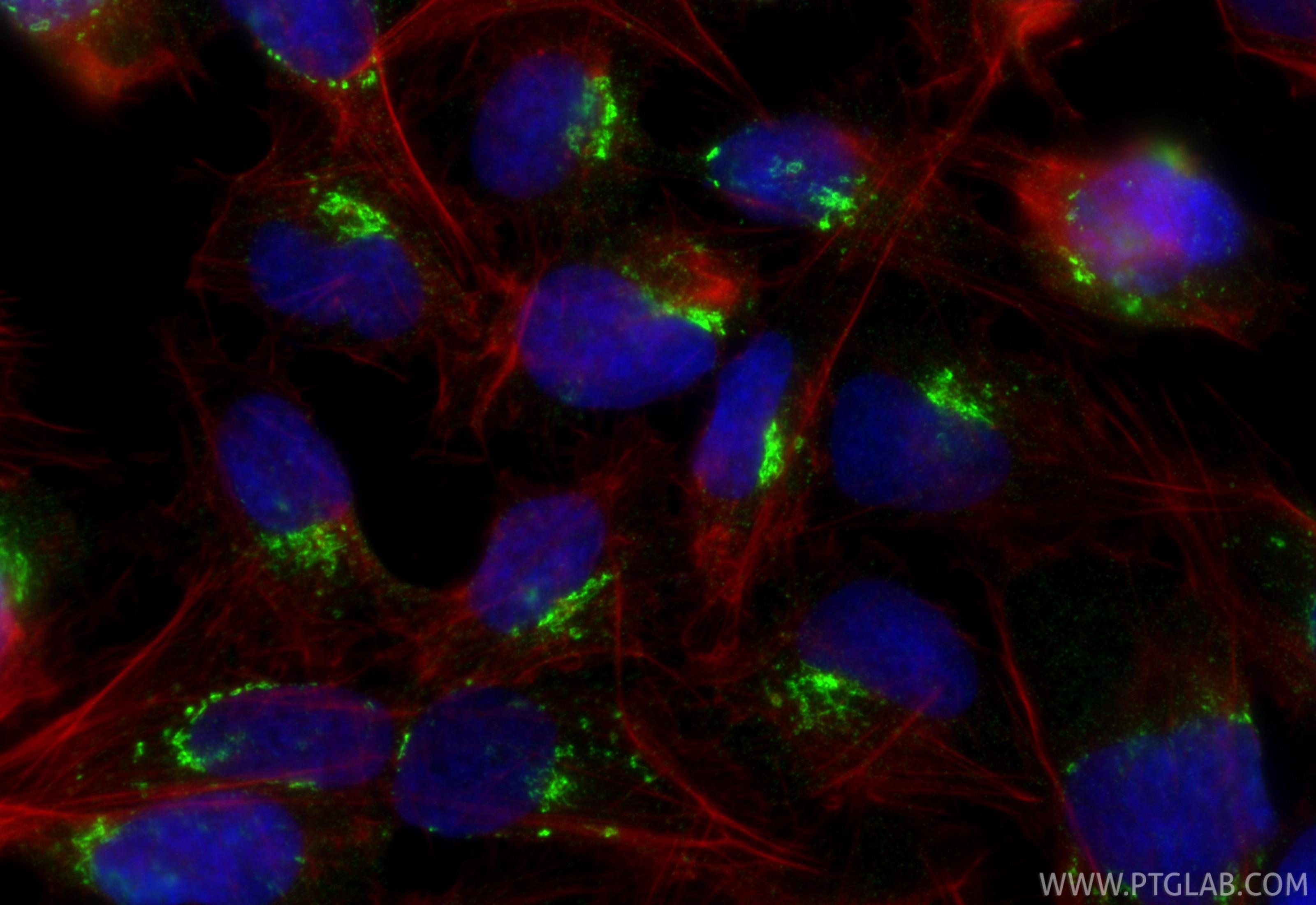 IF Staining of U2OS using 13573-1-AP Immunofluorescence (IF) / fluorescent staining of U2OS cells using TGN46 Polyclonal antibody (13573-1-AP)