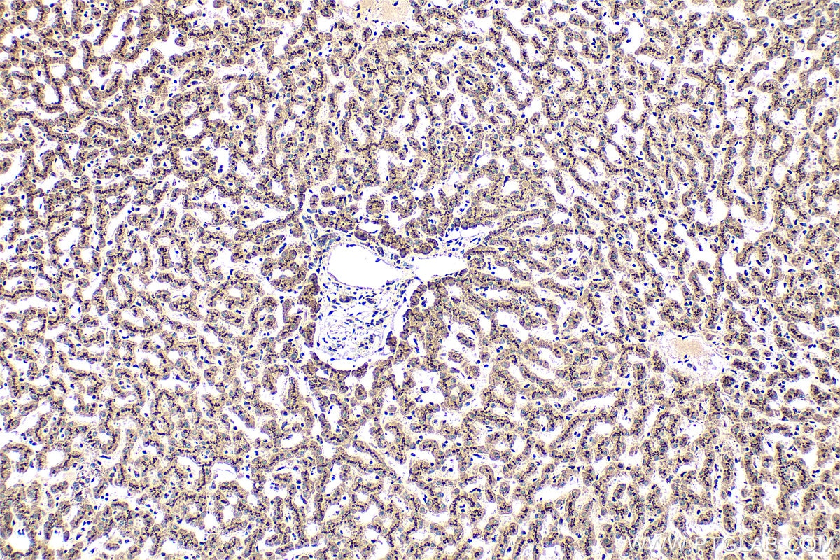 IHC staining of human liver using 13573-1-AP Immunohistochemistry (IHC) staining of human liver tissue using TGN46 Polyclonal antibody (13573-1-AP)