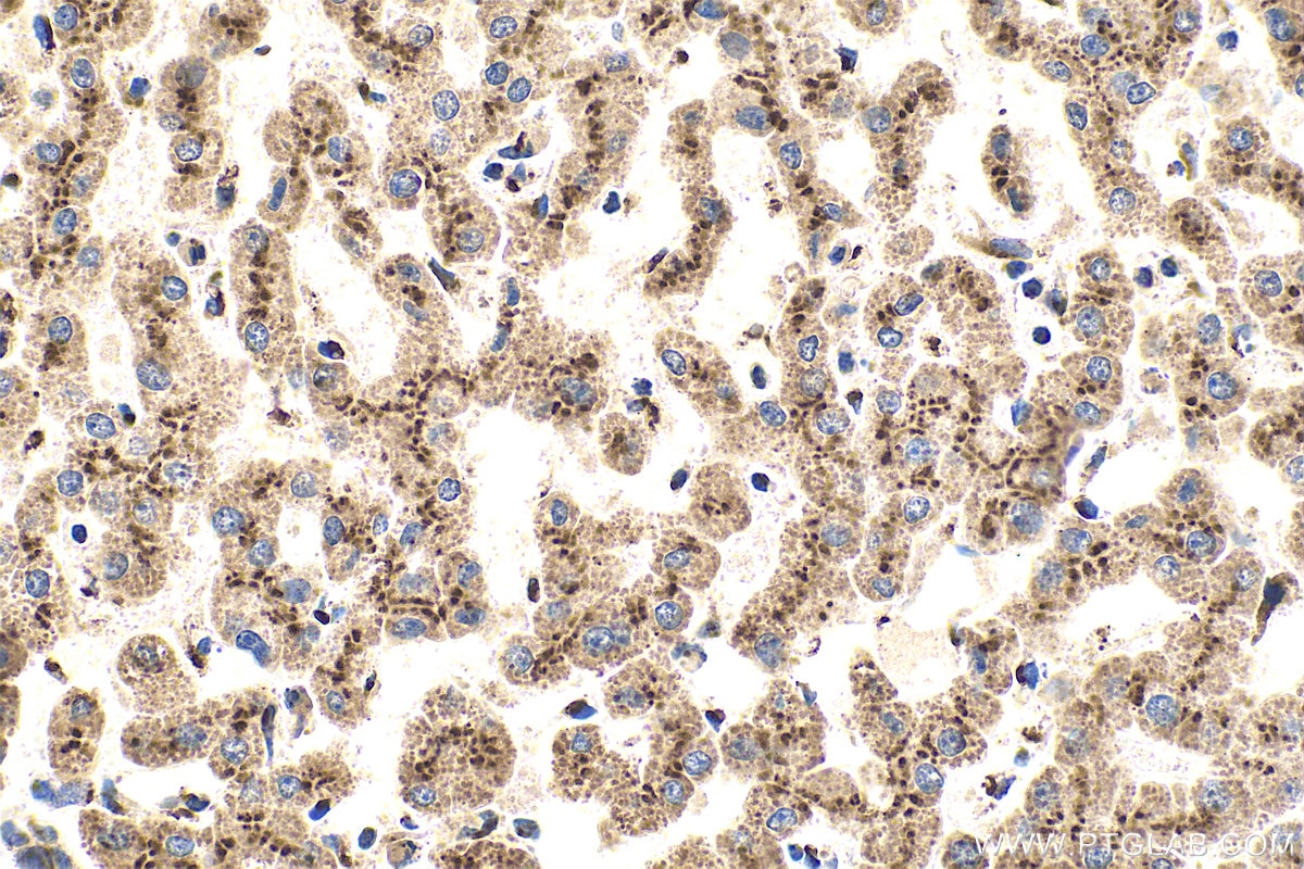 IHC staining of human liver using 13573-1-AP Immunohistochemistry (IHC) staining of human liver tissue using TGN46 Polyclonal antibody (13573-1-AP)