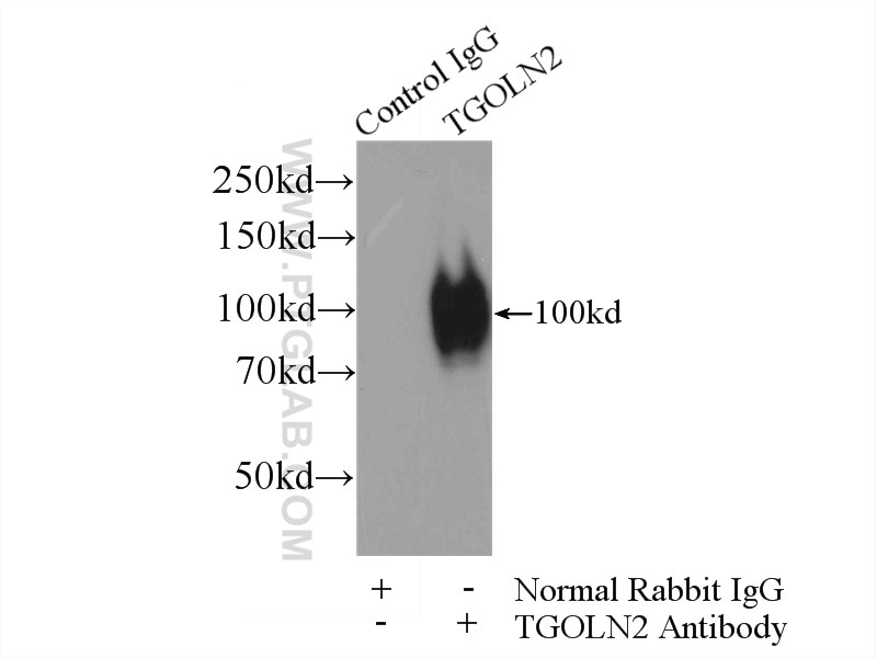 Immunoprecipitation (IP) experiment of HeLa cells using TGN46 Polyclonal antibody (13573-1-AP)