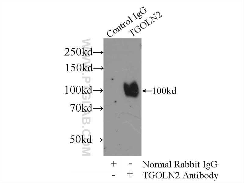 Immunoprecipitation (IP) experiment of HeLa cells using TGN46 Polyclonal antibody (13573-1-AP)