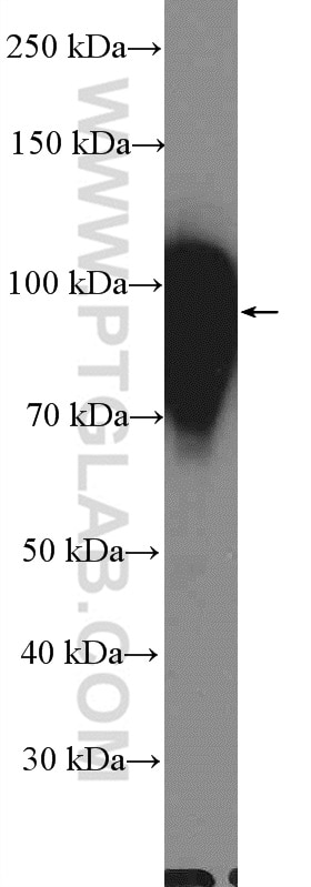 WB analysis of HeLa using 13573-1-AP