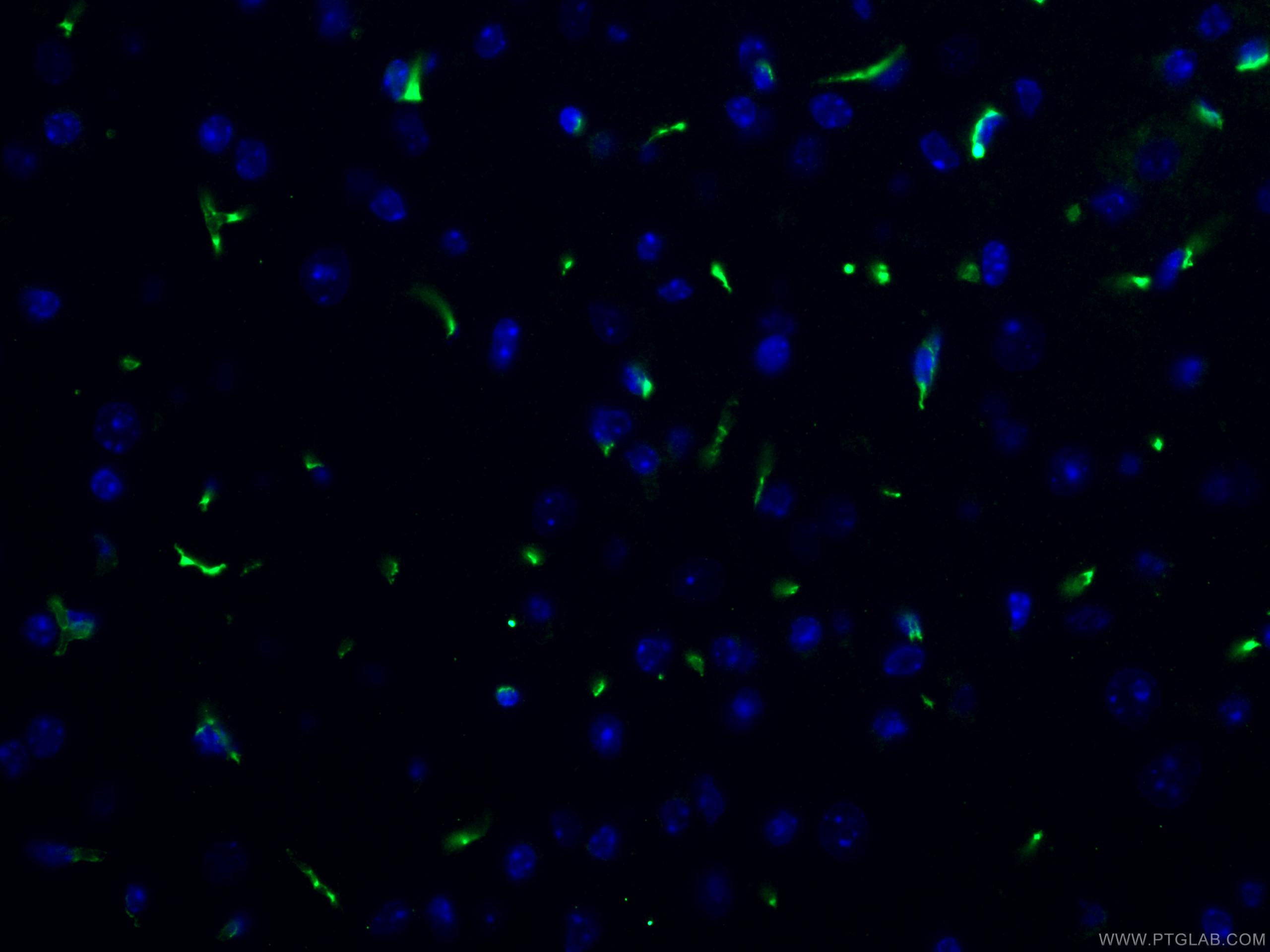 Immunofluorescence (IF) / fluorescent staining of mouse brain tissue using TGN46 Monoclonal antibody (66477-1-Ig)