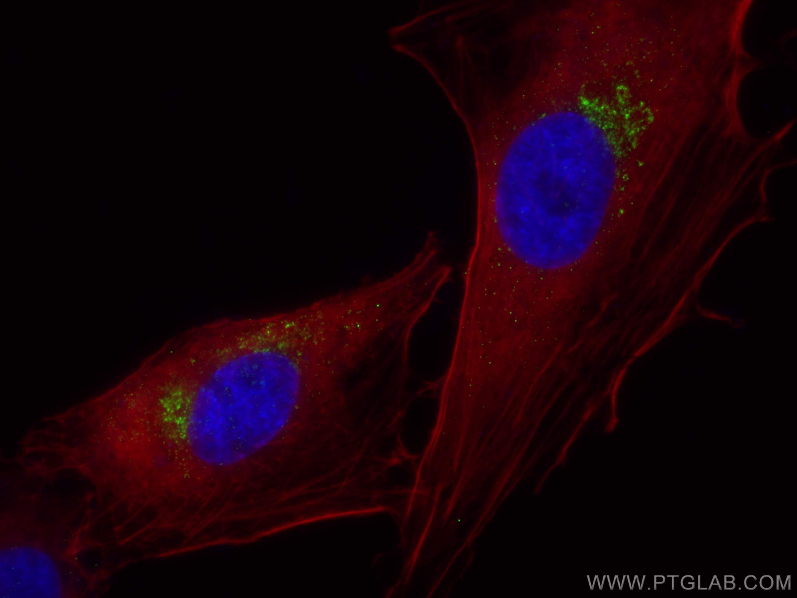 Immunofluorescence (IF) / fluorescent staining of A549 cells using TGN46 Monoclonal antibody (66477-1-Ig)