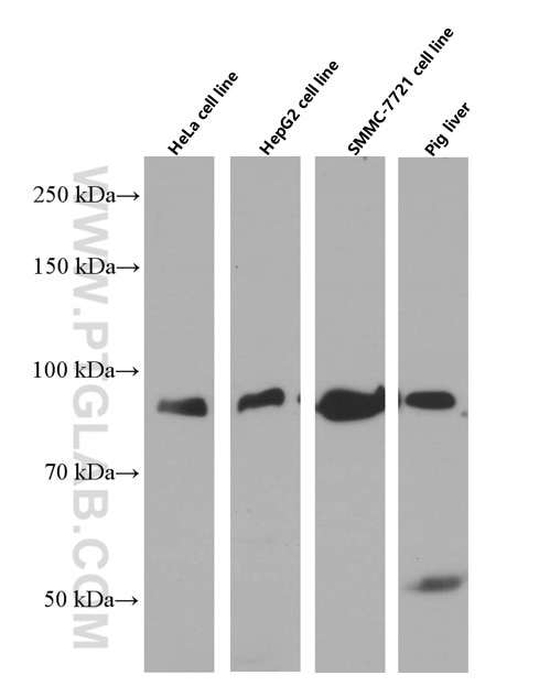Western Blot (WB) analysis of HeLa cells using TGN46 Monoclonal antibody (66477-1-Ig)
