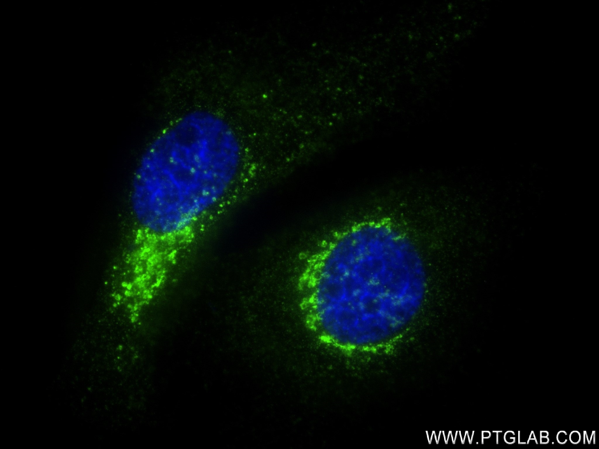 IF Staining of HeLa using 83099-2-RR