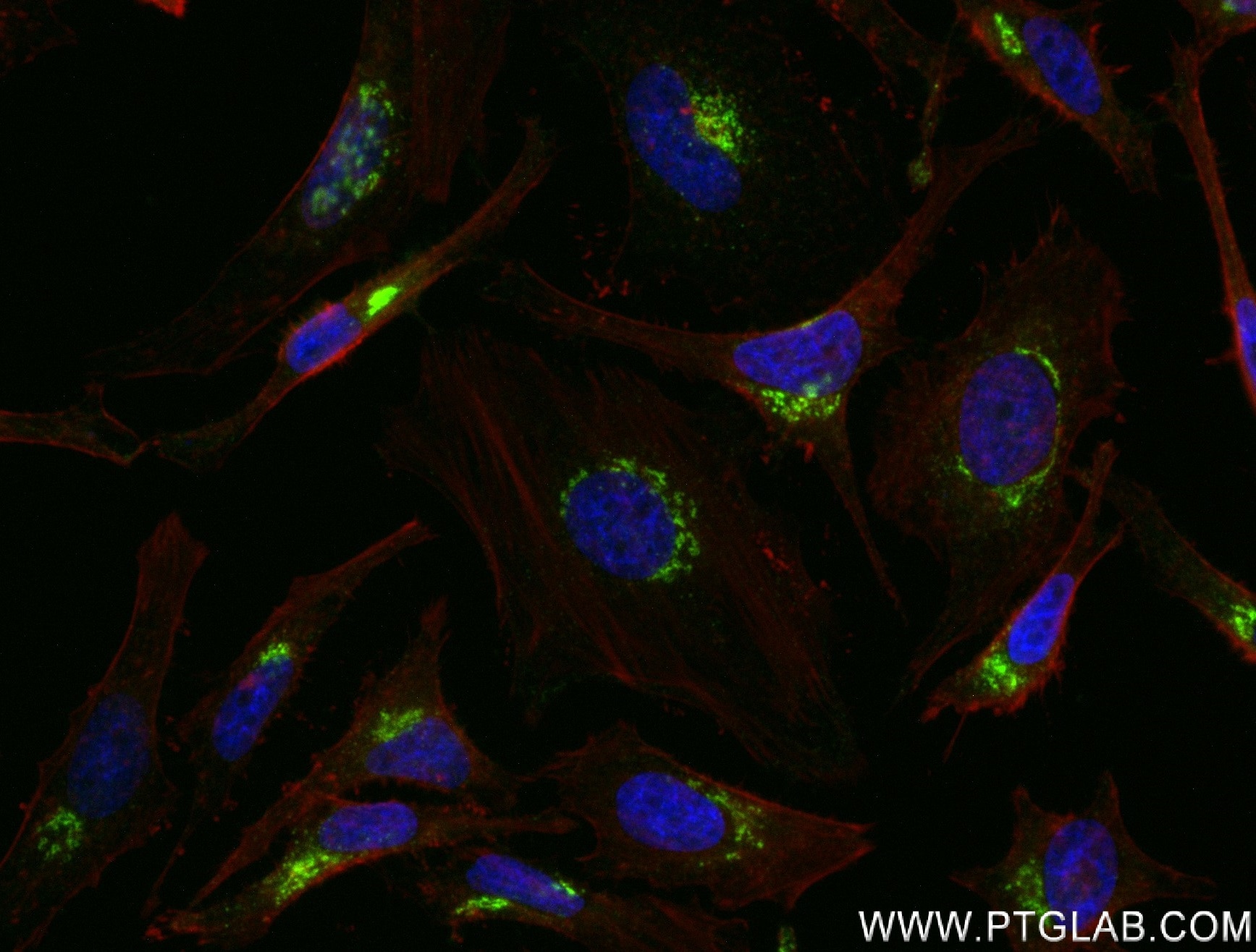 IF Staining of HeLa using 83099-2-RR