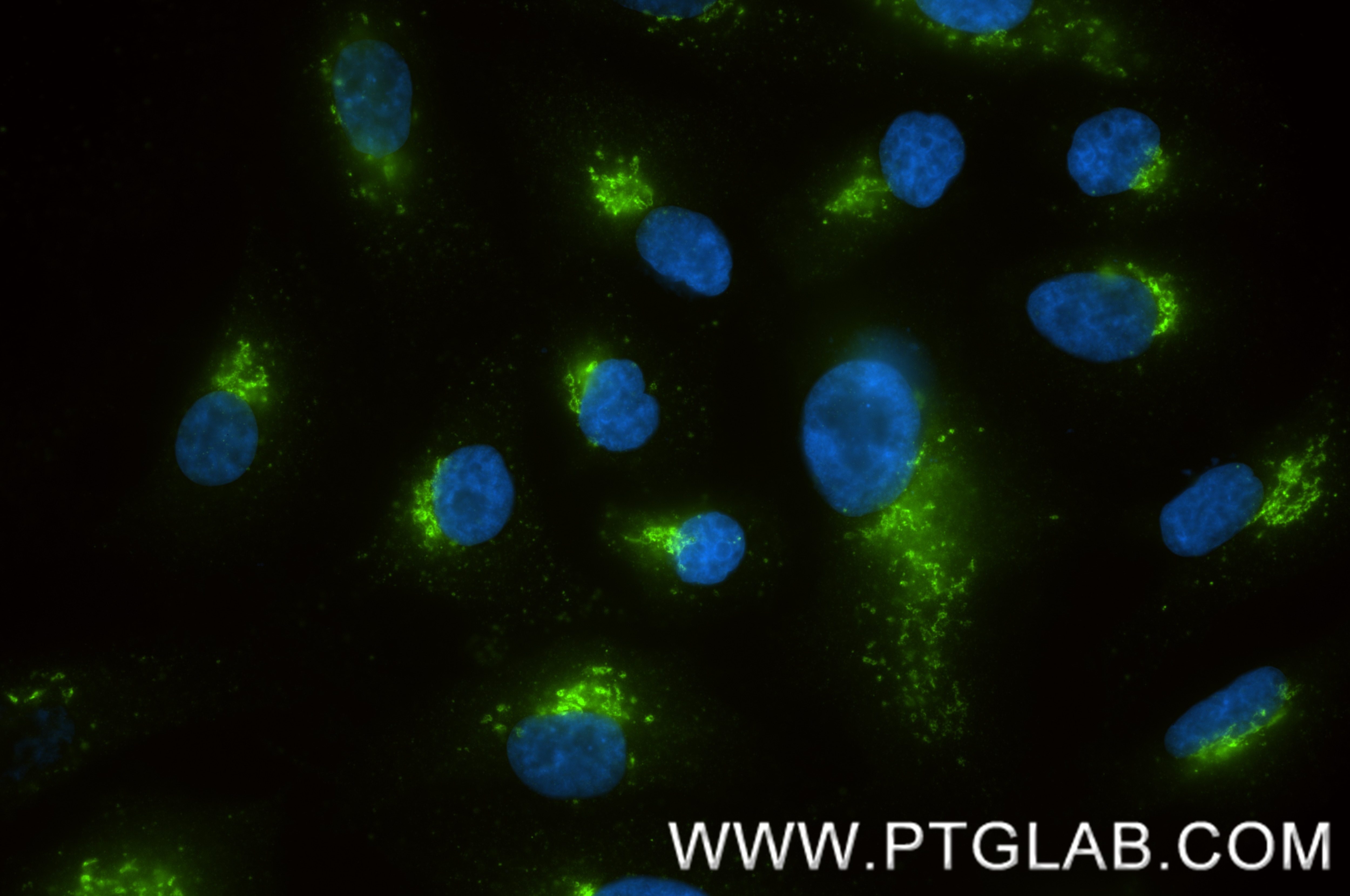 Immunofluorescent analysis of (4% PFA) fixed A549 cells using TGN46 antibody (83099-2-RR, Clone: 230376D6 ) at dilution of 1:400 and CoraLite®488-Conjugated Goat Anti-Rabbit IgG(H+L) (SA00013-2). Immunofluorescence (IF) / fluorescent staining of A549 cells using TGN46 Recombinant monoclonal antibody (83099-2-RR)