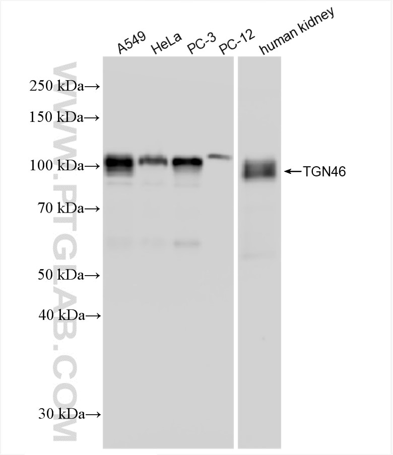 Western Blot (WB) analysis of various lysates using TGOLN2,TGN46 Recombinant antibody (83099-2-RR)