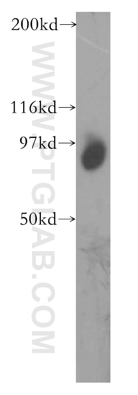 Western Blot (WB) analysis of mouse testis tissue using TGS1 Polyclonal antibody (13034-1-AP)