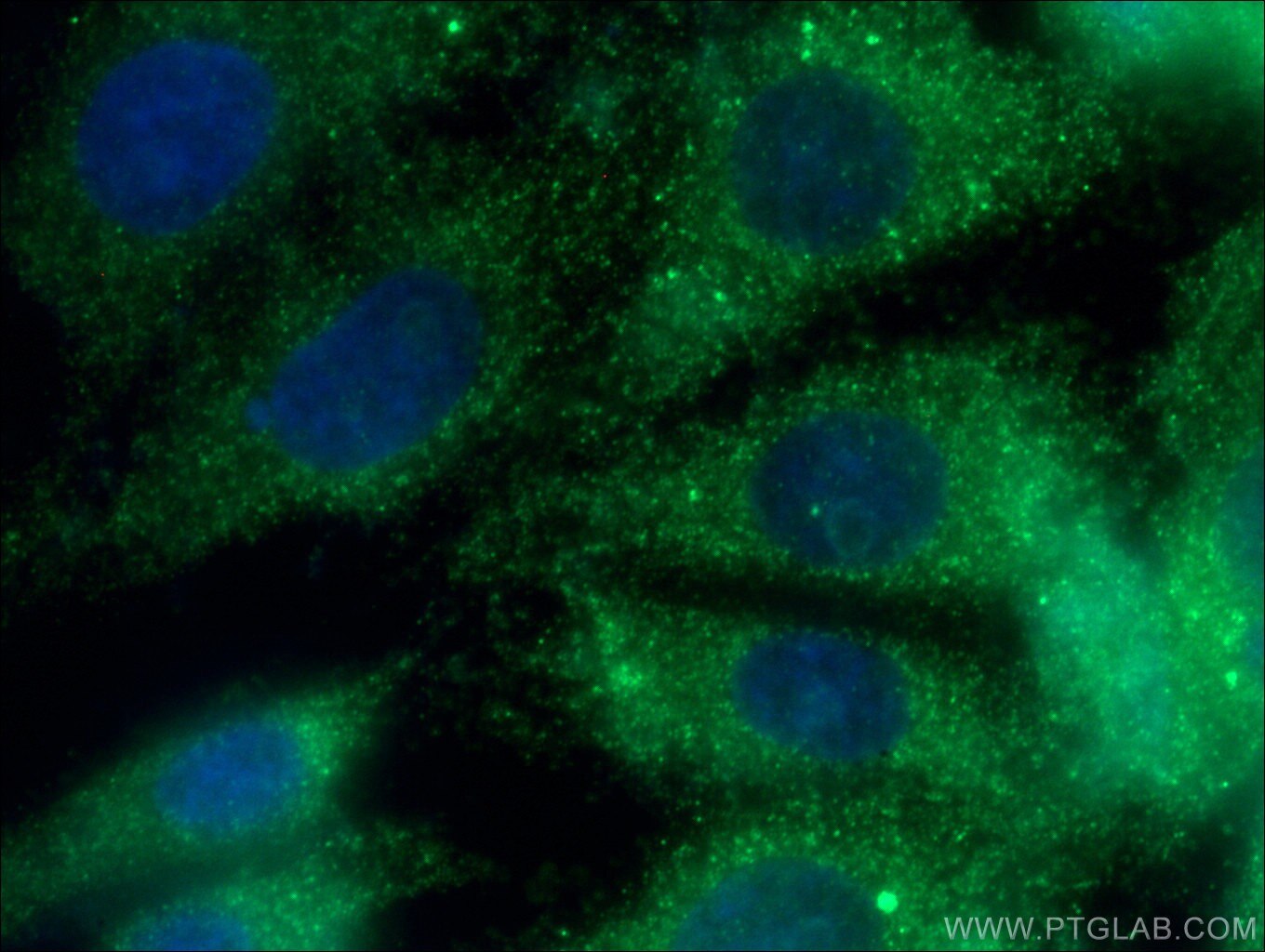 Immunofluorescence (IF) / fluorescent staining of SH-SY5Y cells using TH Polyclonal antibody (25859-1-AP)