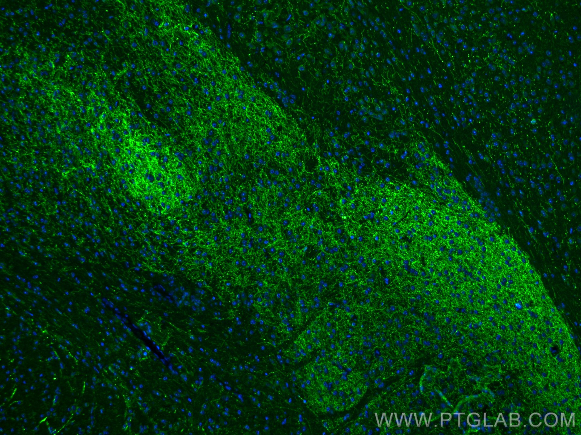 Immunofluorescence (IF) / fluorescent staining of mouse brain tissue using TH Polyclonal antibody (25859-1-AP)