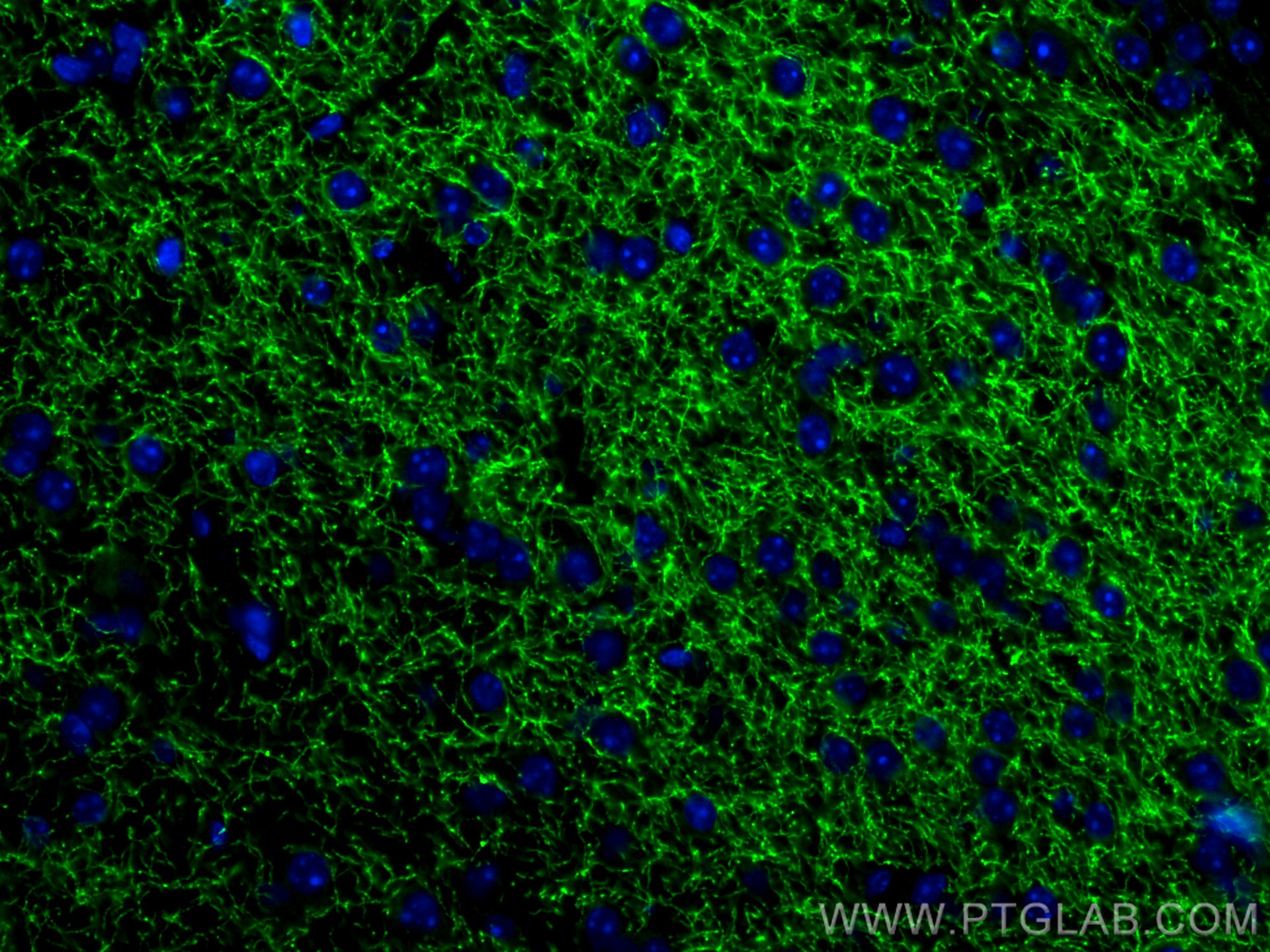 Immunofluorescence (IF) / fluorescent staining of mouse brain tissue using TH Polyclonal antibody (25859-1-AP)