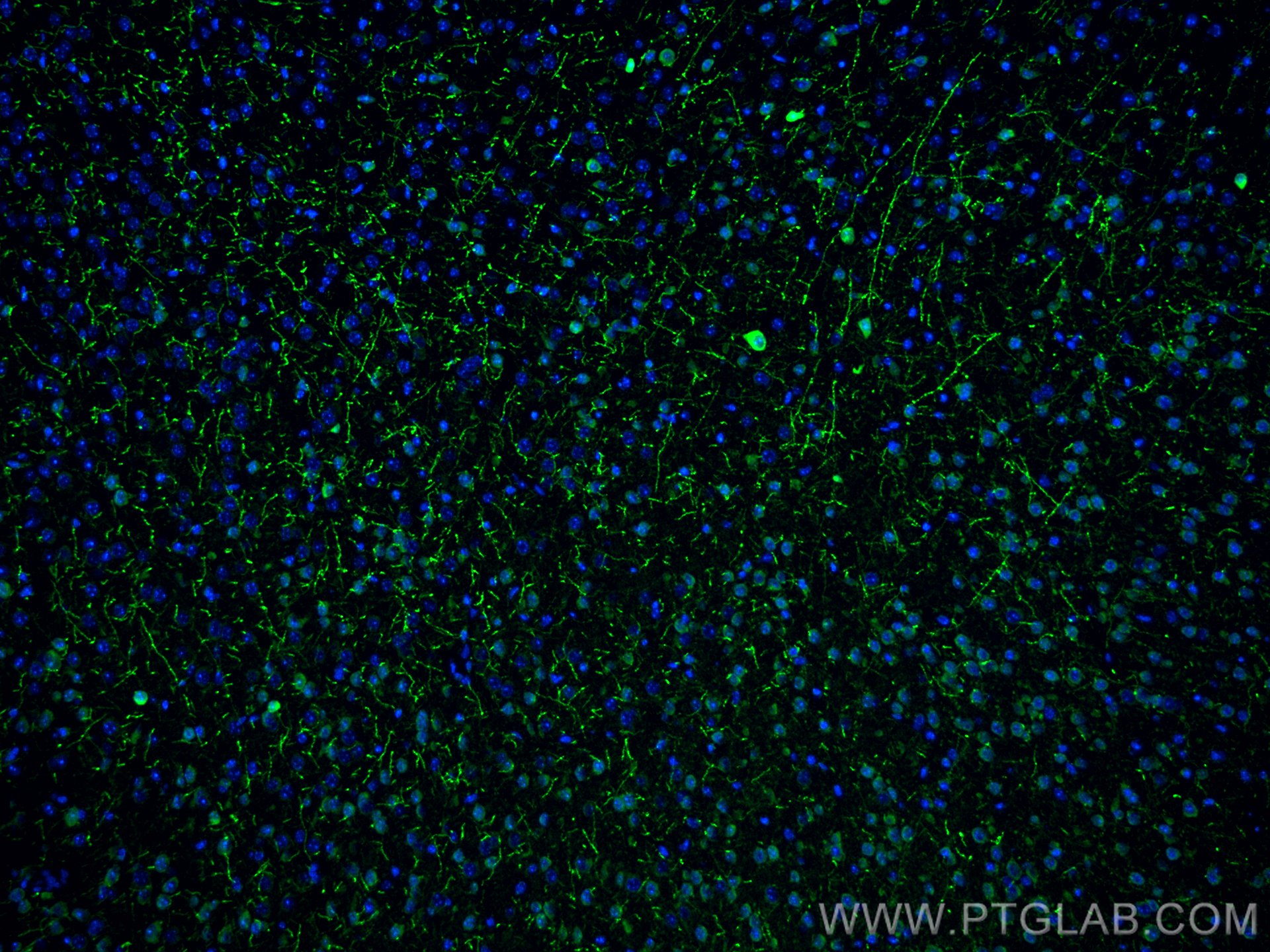 Immunofluorescence (IF) / fluorescent staining of mouse brain tissue using TH Polyclonal antibody (25859-1-AP)