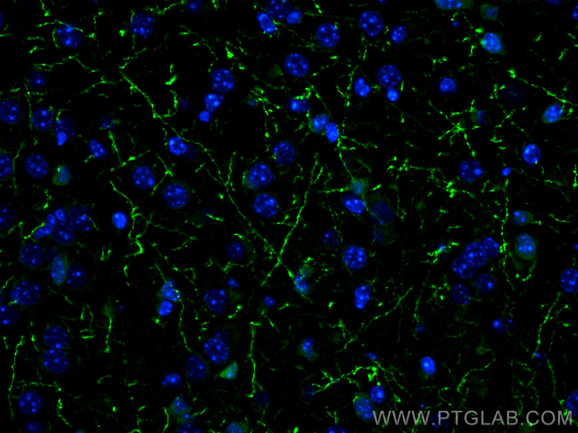 IF Staining of mouse brain using 25859-1-AP
