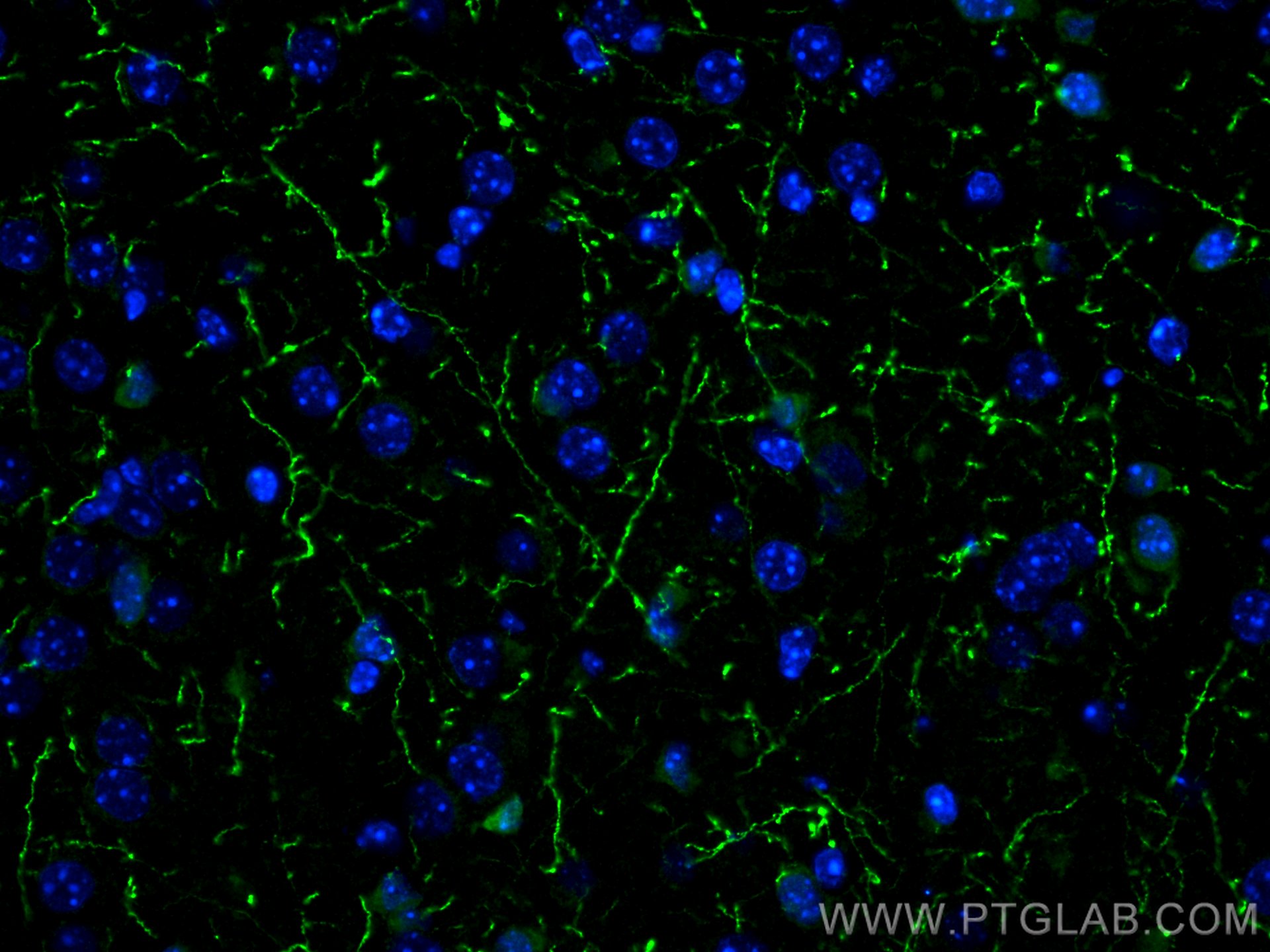 Immunofluorescence (IF) / fluorescent staining of mouse brain tissue using TH Polyclonal antibody (25859-1-AP)