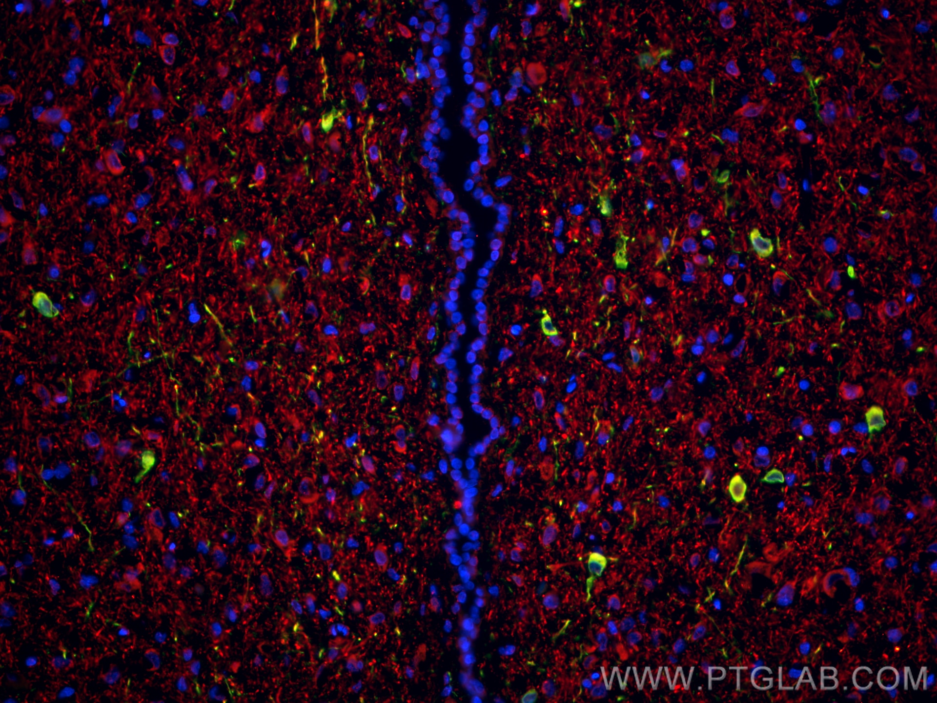 Immunofluorescence (IF) / fluorescent staining of rat brain tissue using TH Polyclonal antibody (25859-1-AP)
