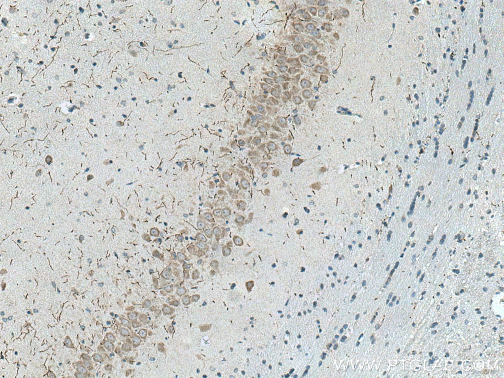 IHC staining of rat brain using 25859-1-AP