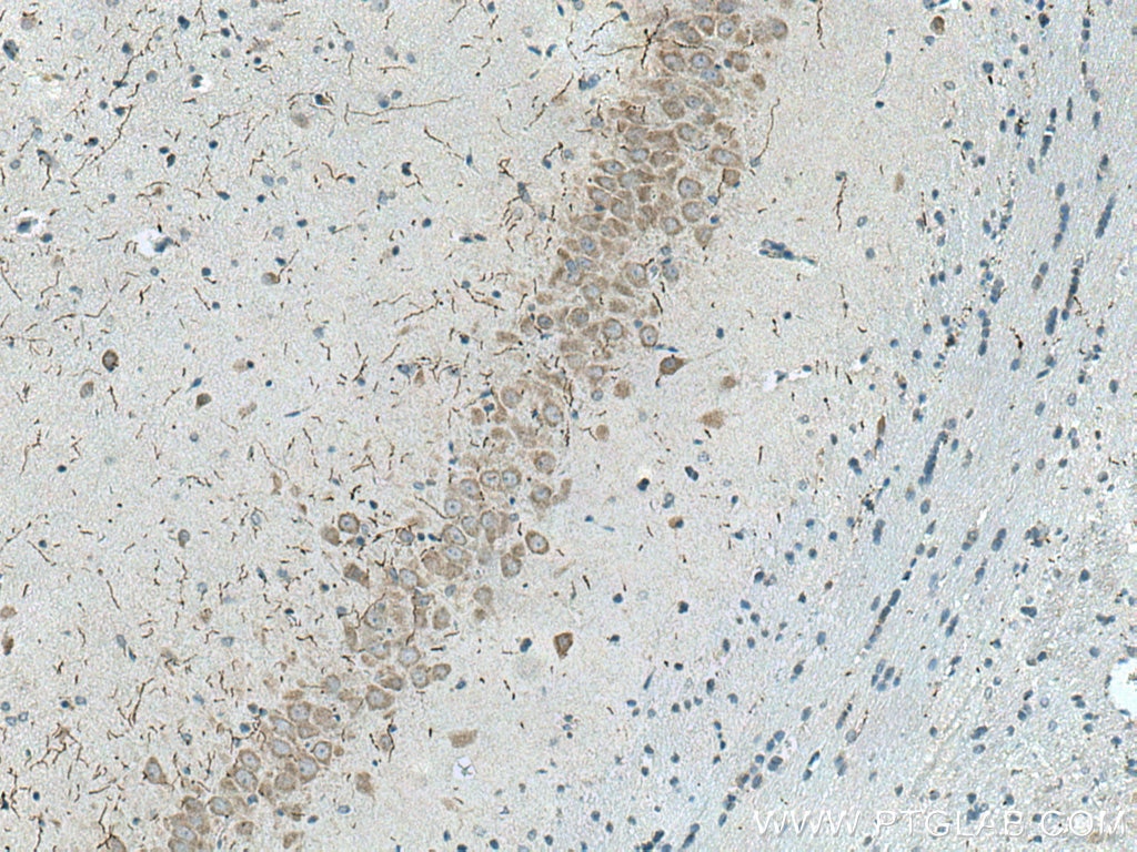 Immunohistochemistry (IHC) staining of rat brain tissue using TH Polyclonal antibody (25859-1-AP)