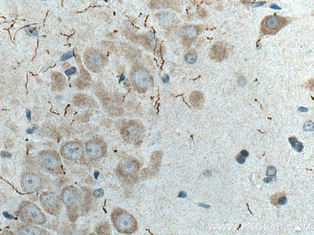 IHC staining of rat brain using 25859-1-AP