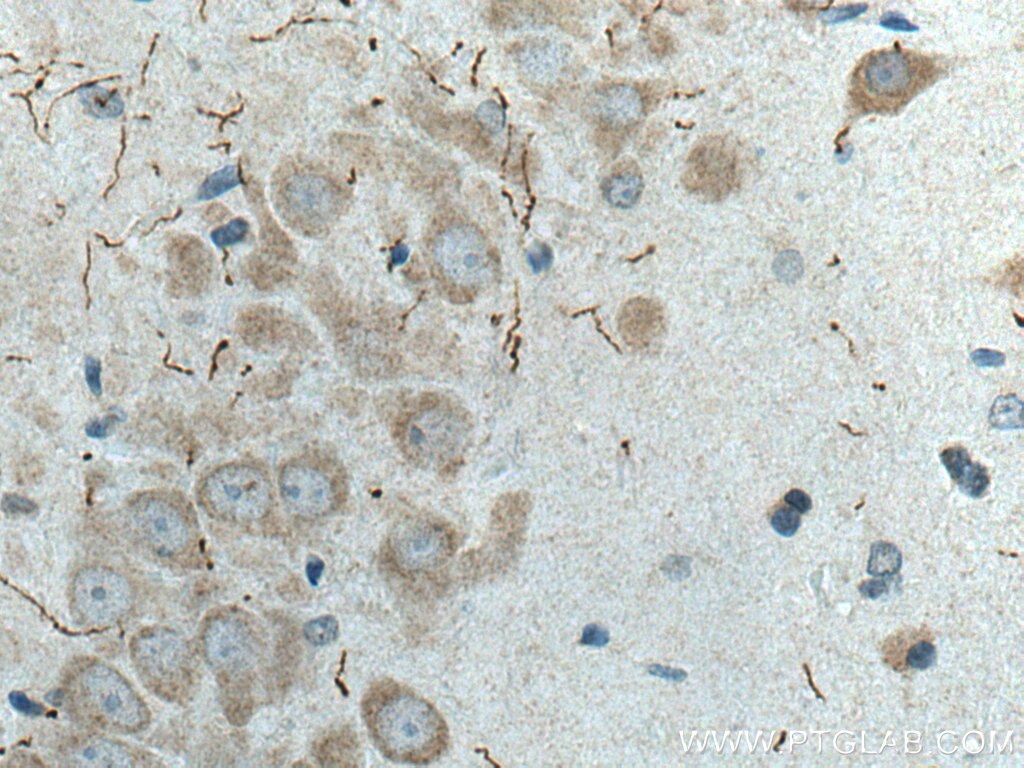 Immunohistochemistry (IHC) staining of rat brain tissue using TH Polyclonal antibody (25859-1-AP)