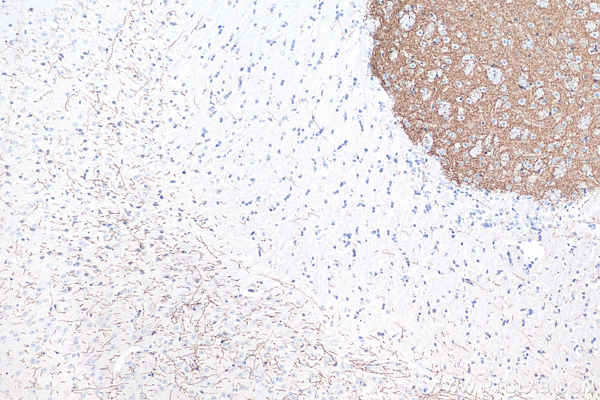 Immunohistochemistry (IHC) staining of mouse brain tissue using TH Polyclonal antibody (25859-1-AP)