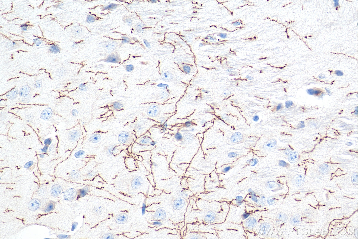 IHC staining of mouse brain using 25859-1-AP