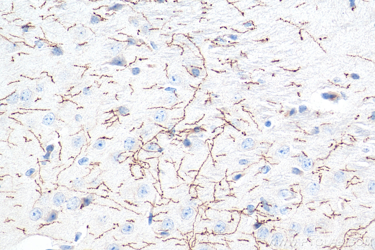 Immunohistochemistry (IHC) staining of mouse brain tissue using TH Polyclonal antibody (25859-1-AP)