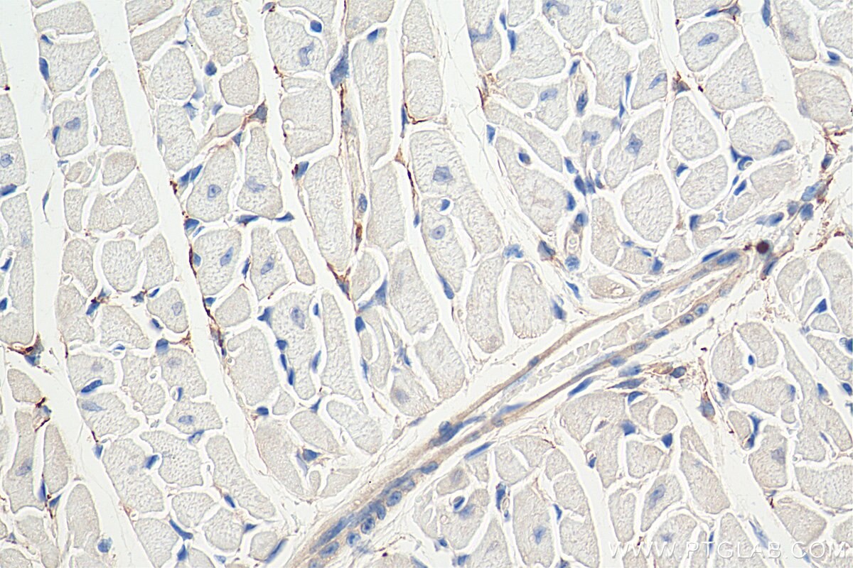 Immunohistochemistry (IHC) staining of mouse heart tissue using TH Polyclonal antibody (25859-1-AP)