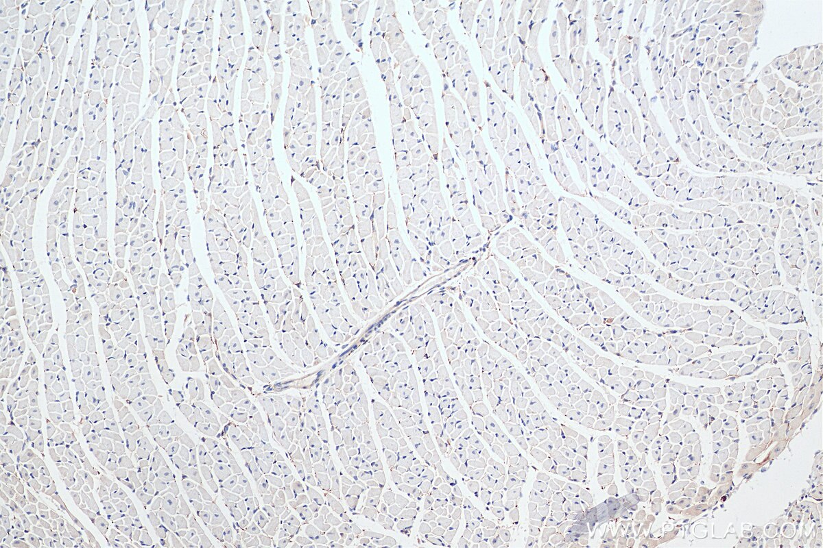 Immunohistochemistry (IHC) staining of mouse heart tissue using TH Polyclonal antibody (25859-1-AP)