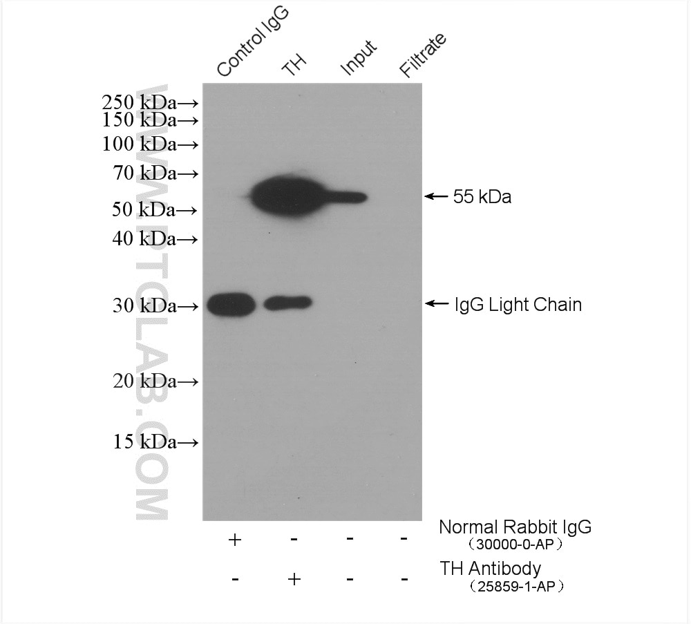 Immunoprecipitation (IP) experiment of mouse brain tissue using TH Polyclonal antibody (25859-1-AP)