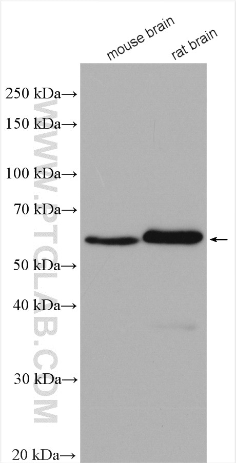 Western Blot (WB) analysis of various lysates using TH Polyclonal antibody (25859-1-AP)