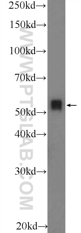 TH Polyclonal antibody