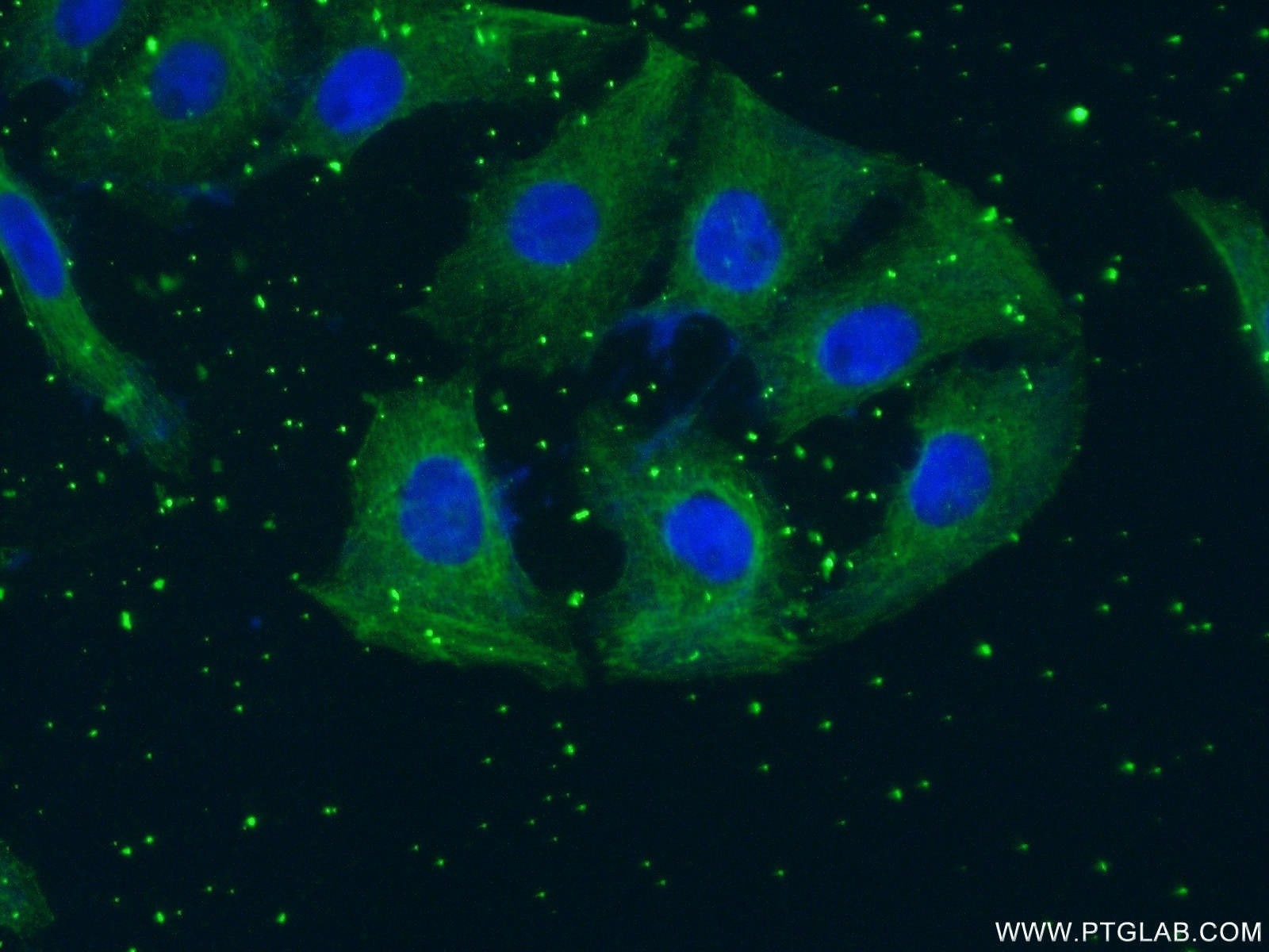 Immunofluorescence (IF) / fluorescent staining of SH-SY5Y cells using TH Monoclonal antibody (66334-1-Ig)