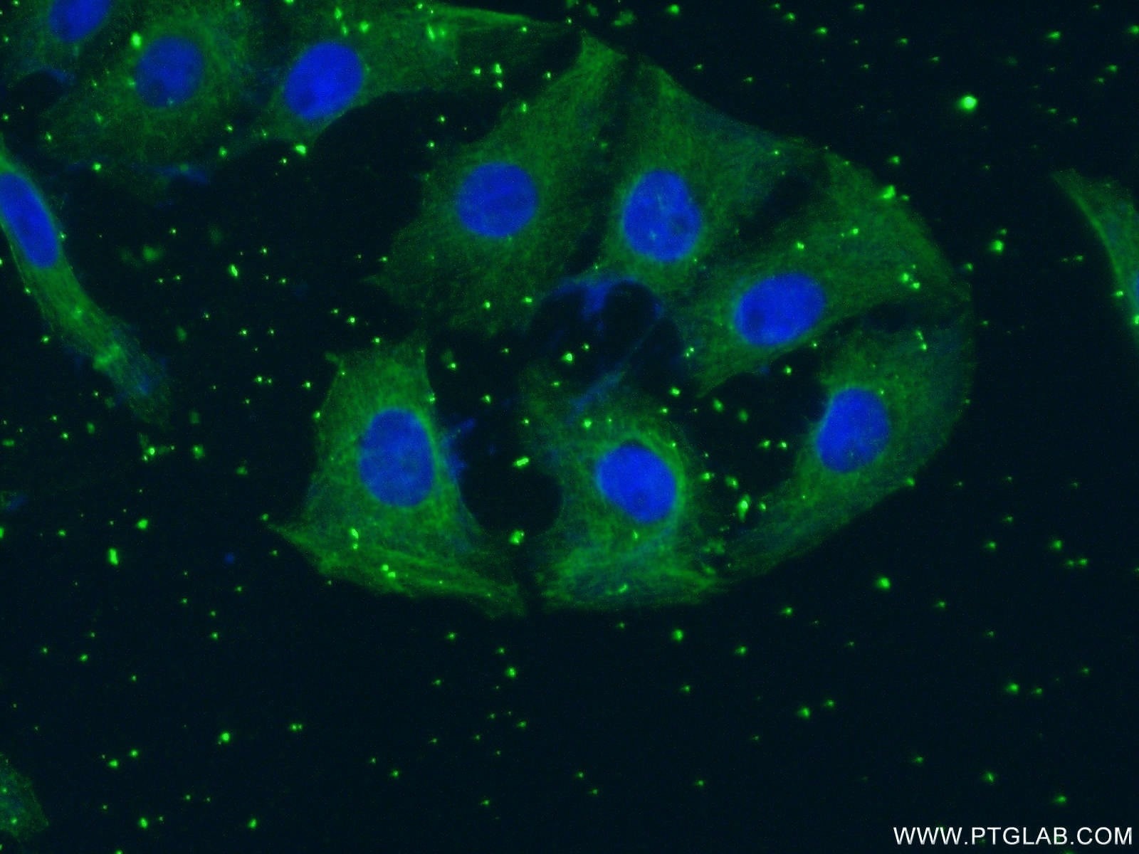 IF Staining of SH-SY5Y using 66334-1-Ig